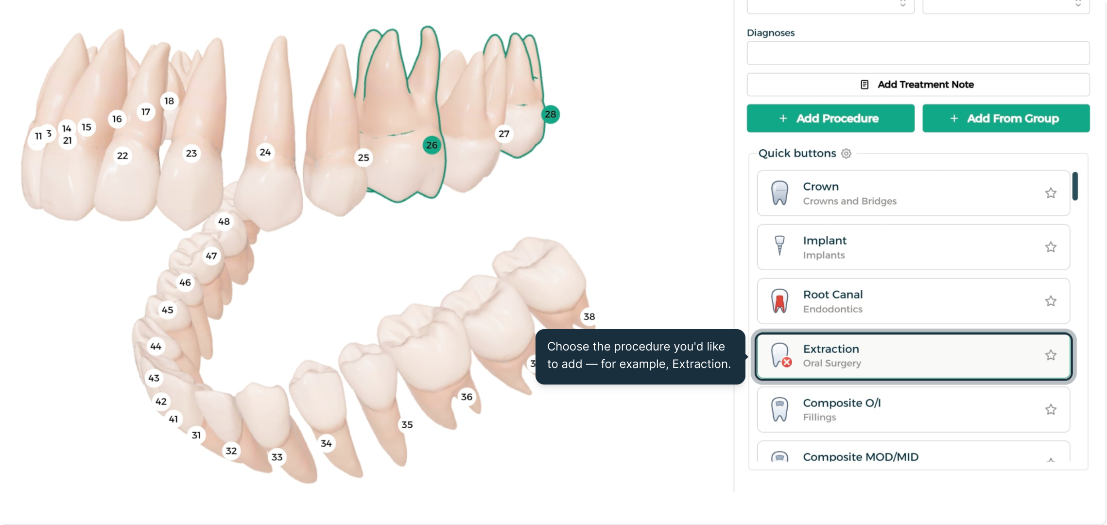 Step 3 - Choose a procedure