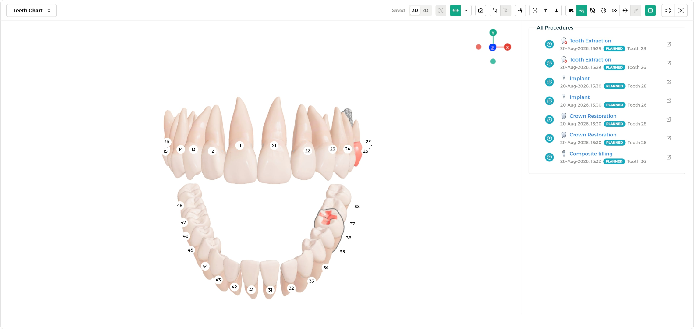 Step 1 - All procedures on the chart