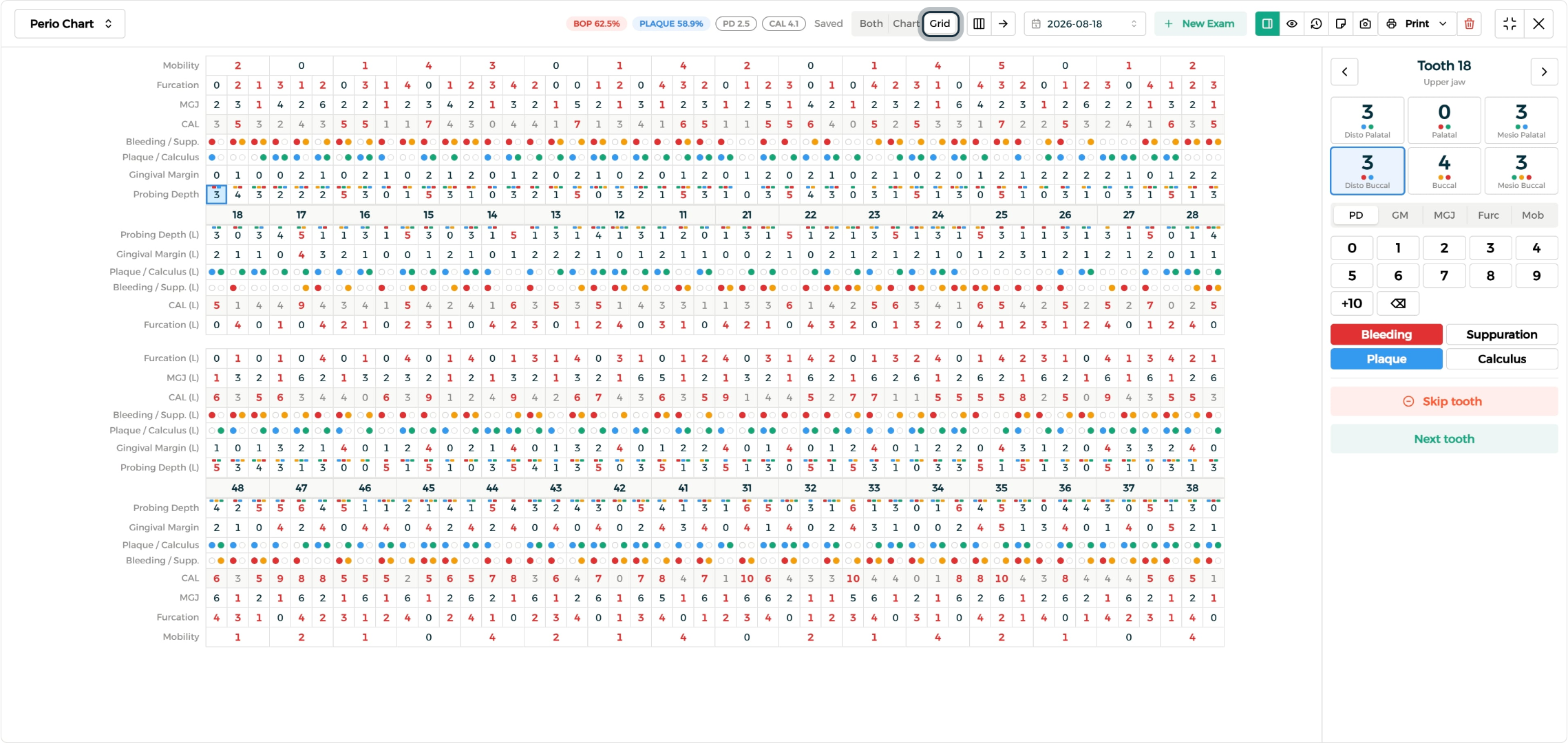 Step 1 - Chart and grid views